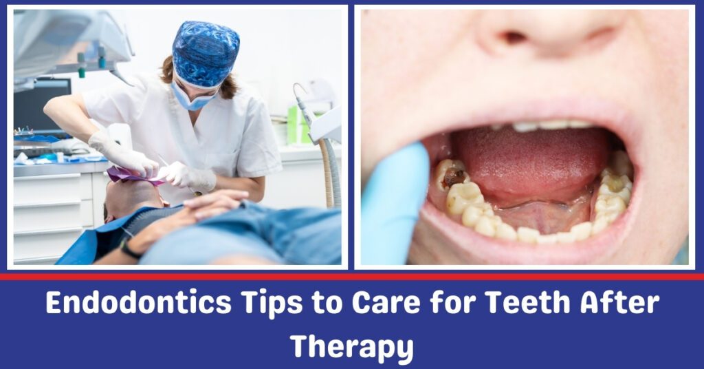 Endodontics Tips to Cares for Teeth After Therapy - Zainab Dental Clinic