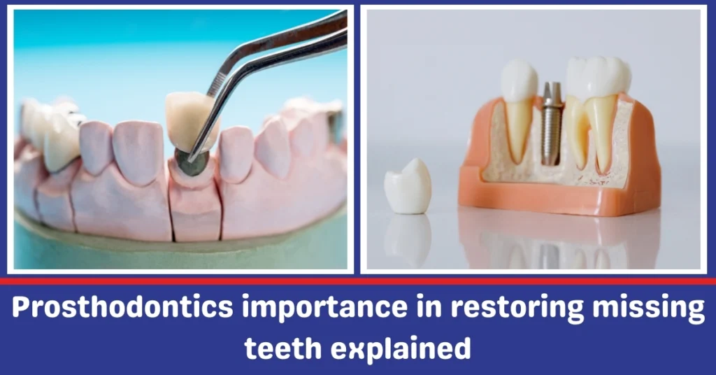 Prosthodontics importance in restoring missing teeth explaineds