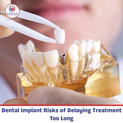 Dental Implant Risks of Delaying Treatment Too Long