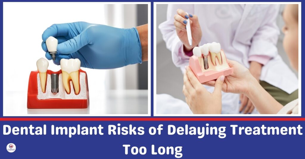 Dental Implant Risks of Delaying Treatment Too Longs