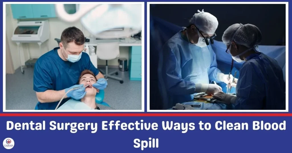 Dental Surgery Effective Ways to Clean Blood Spills