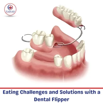 Eating Challenges and Solutions with a Dental Flipper
