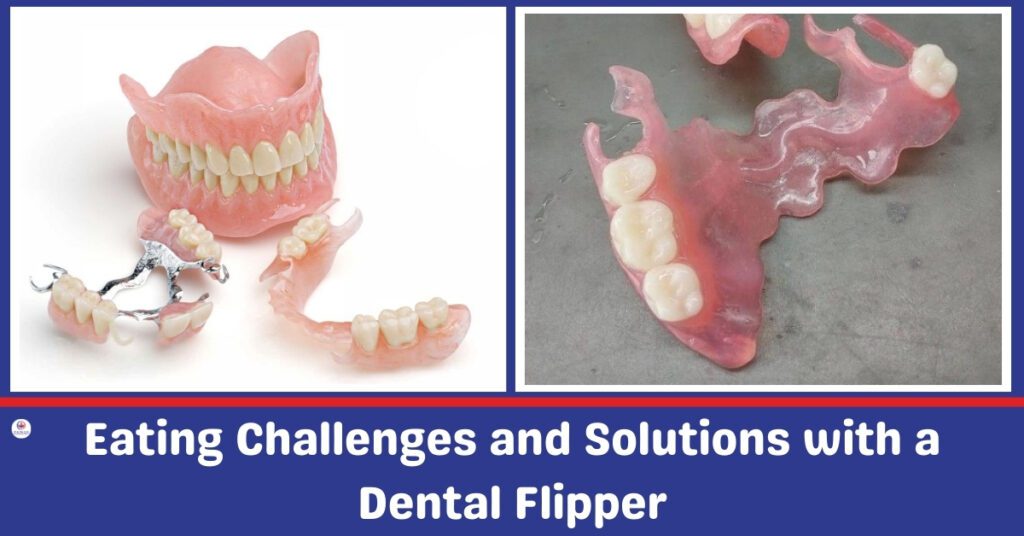 Eating Challenges and Solutions with a Dental Flippers