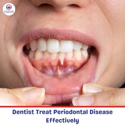 Dentist Treat Periodontal Disease Effectively